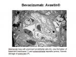 img-bevacizumab-0022.jpg