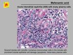 img-Mefenamic acid-0006.jpg